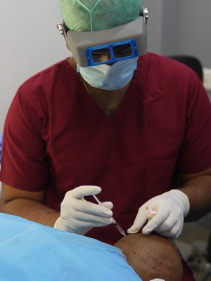 best hair transplant clinic in Chennai